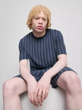 Randig pyjamasar
